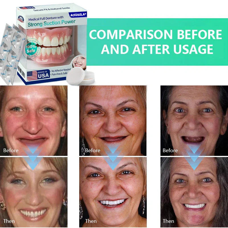 ✨Ends Today: 70% OFF!  ⏰Acezozla® Medical Full Denture with Strong Suction ✅